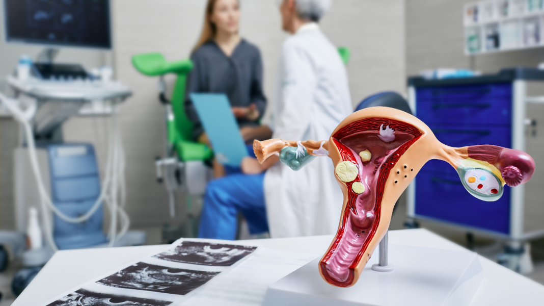 Saúde: USF ‘Dr. Névio Ozzetti’ convoca mulheres para retirada de resultados de exames de Papanicolau